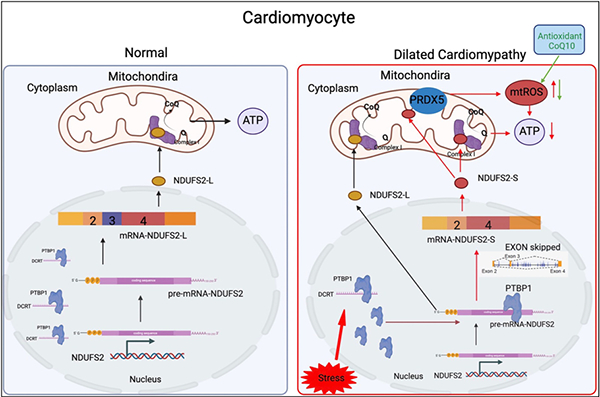中国心肌扩张最新疗法步骤指南,创新治疗策略揭秘