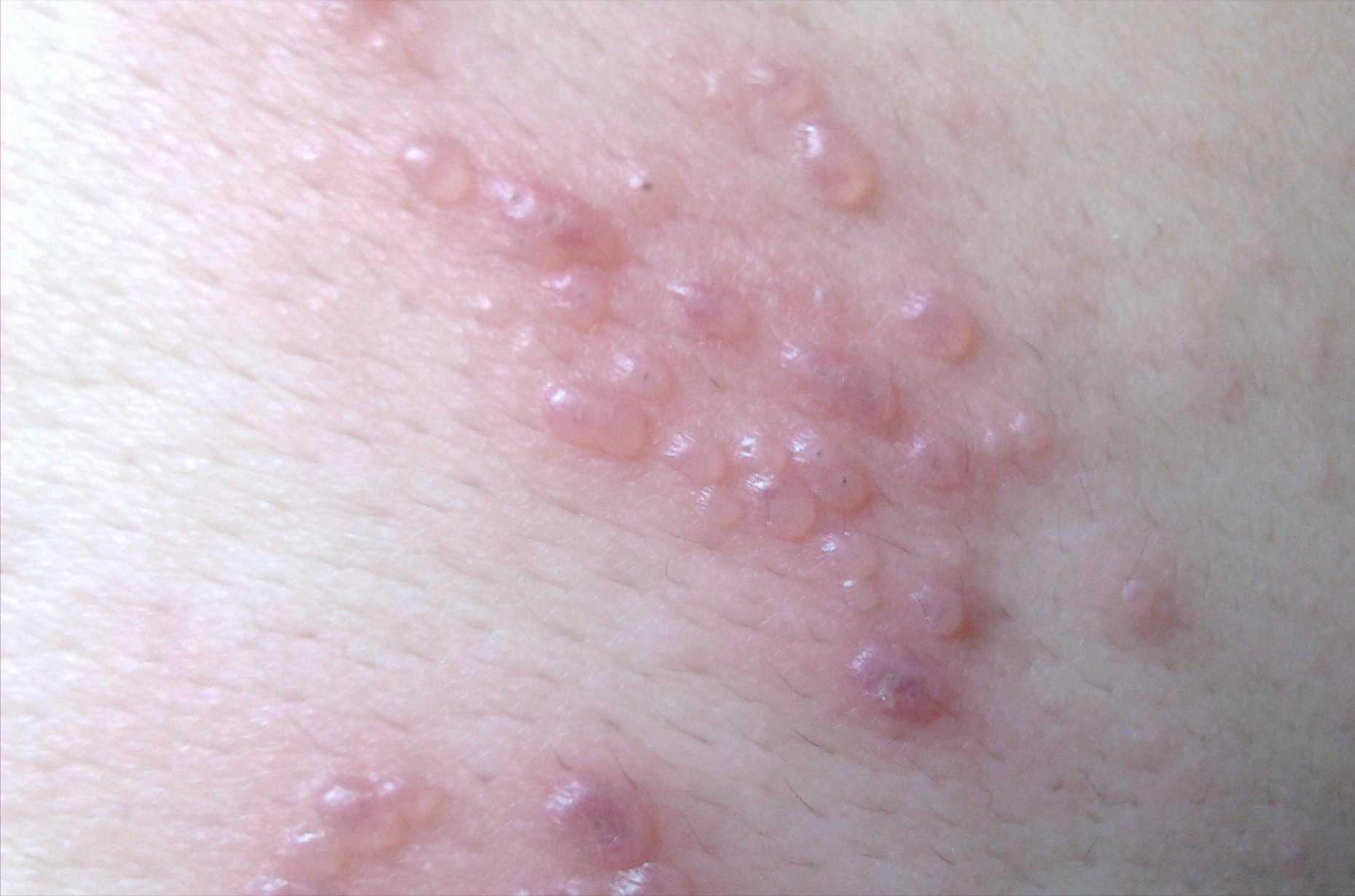 江苏恩替卡韦最新价格揭秘🔍