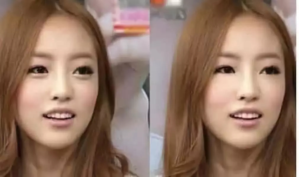 韩国最新整容详解，步骤指南与技巧分享