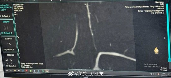 全球最新疫情动态与健康趋势观察分析