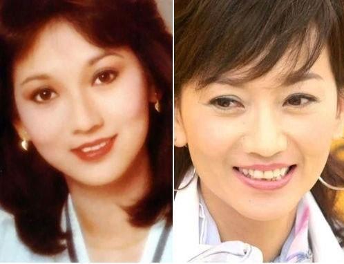 龅牙明星,缺陷中的独特魅力