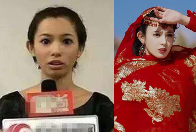 龅牙明星,缺陷中的独特魅力