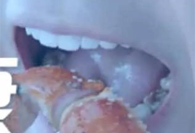 明星牙齿健康揭秘,关注蛀牙与口腔护理的重要性