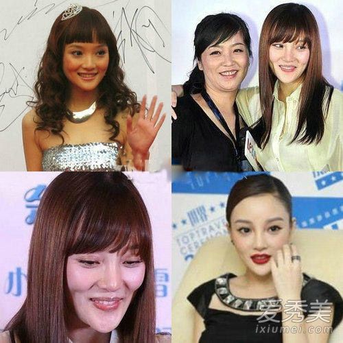 整容后遗症明星的心灵与自然美景之旅探索