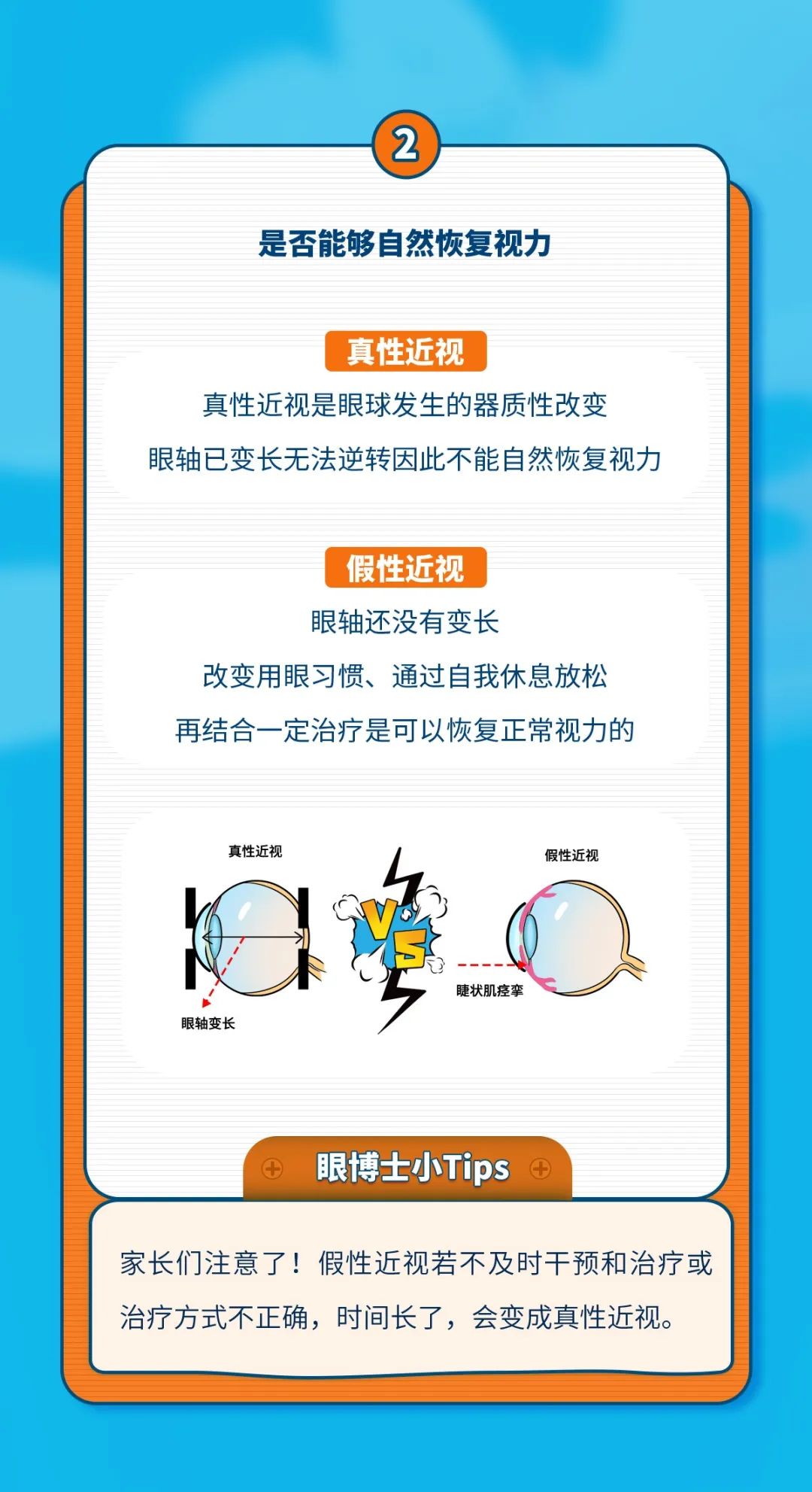 治疗近视最新进展与消息更新