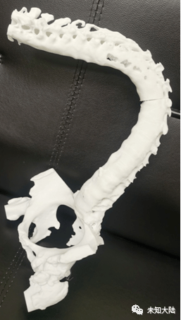 3D打印髋关节最新进展论述,技术革新与应用前景