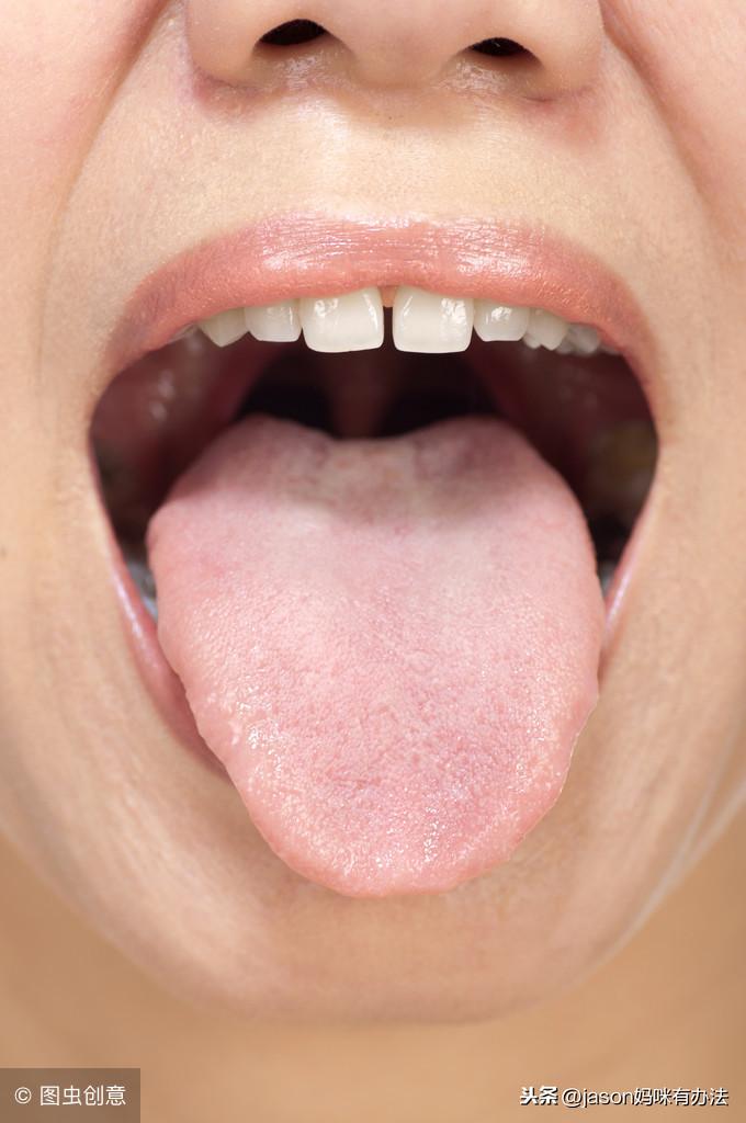 最新疾病地图全面解读与观点阐述,最新疾病趋势分析报告呈现!