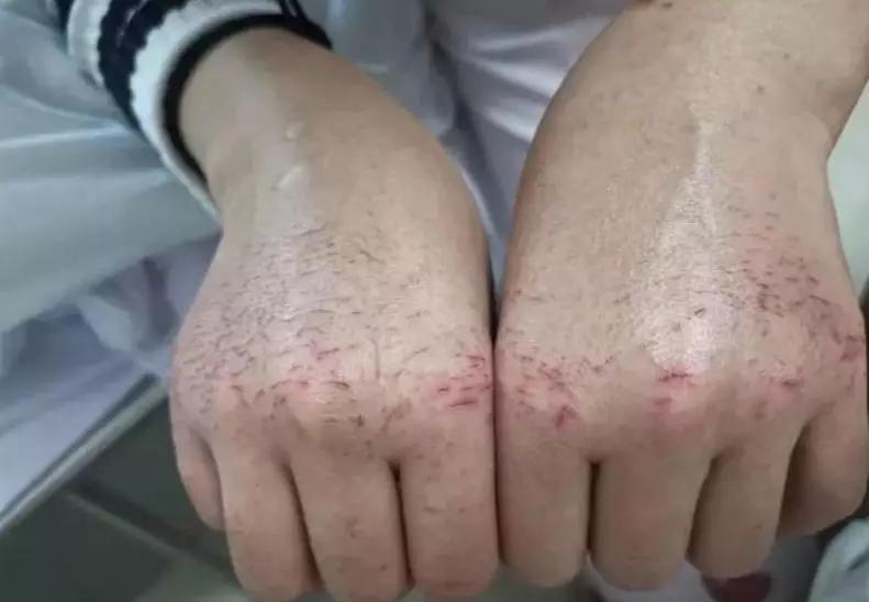 新型肺炎实时通报与探索自然美景的心灵之旅