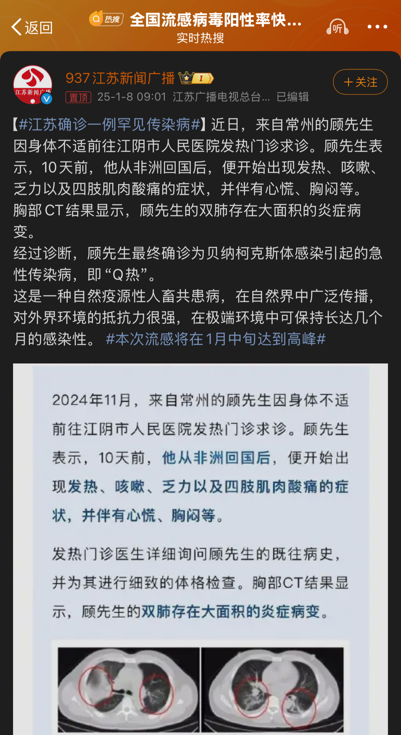 牛皮癣最新动态，变化的力量助力自信与成就之源